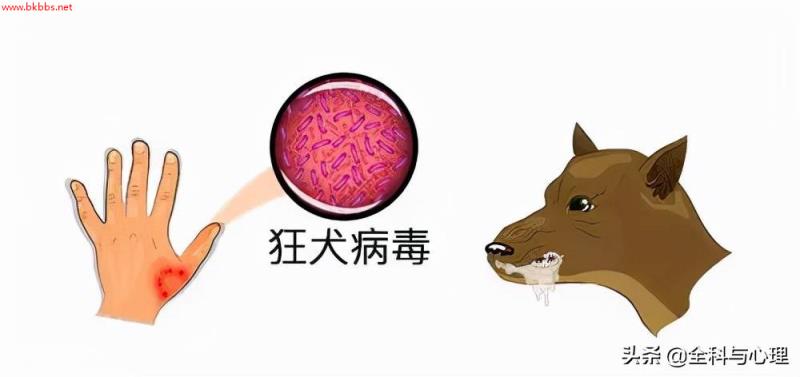 被狗咬了，一定要24小时内打狂犬病疫苗吗？
