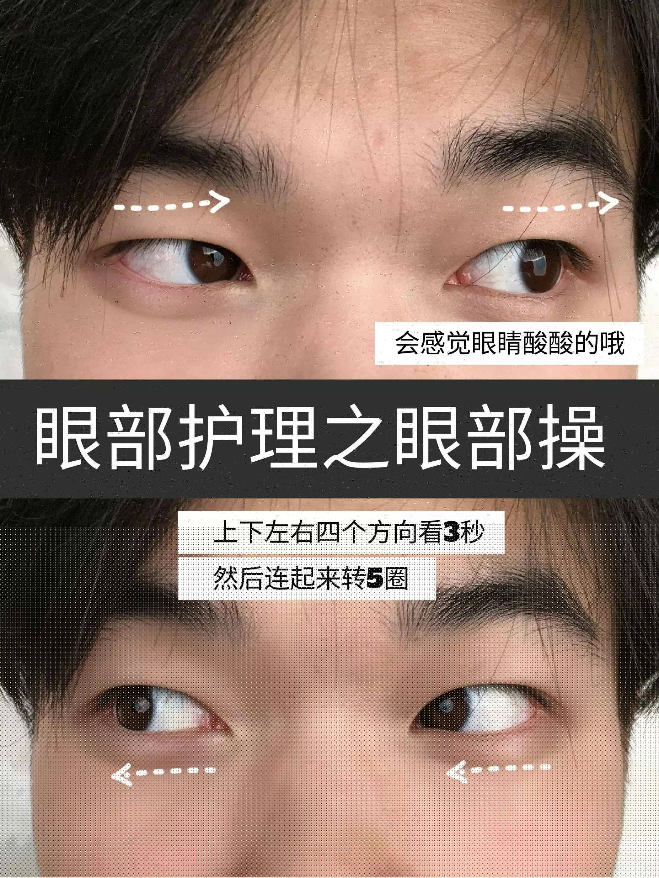 三周淡化黑眼圈全过程的效果反馈！熬夜党冲