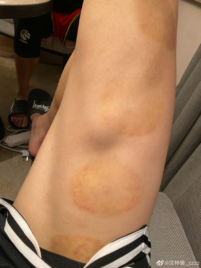 沈梓捷缺席 沈梓捷什么水平